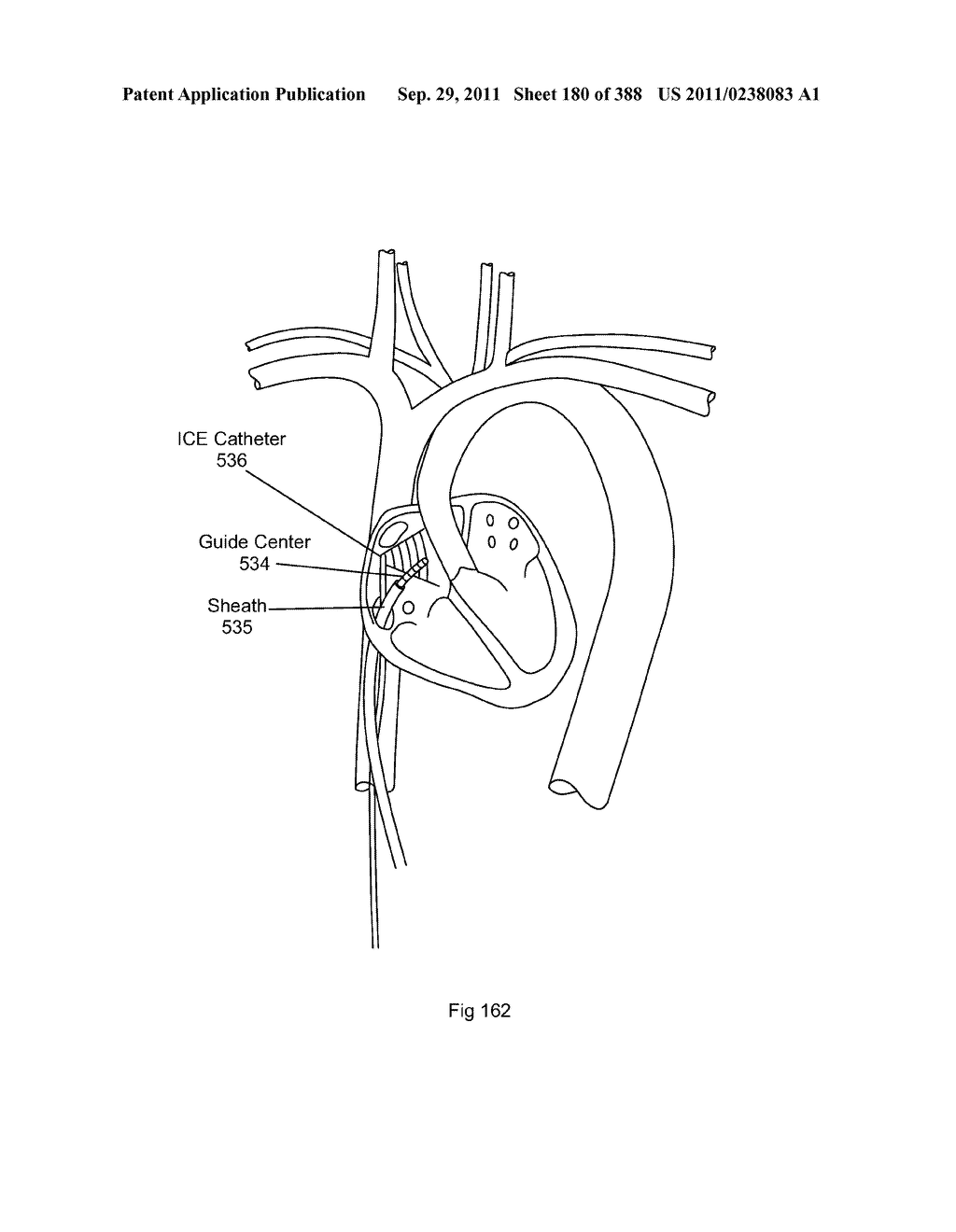 ROBOTIC CATHETER SYSTEM AND METHODS - diagram, schematic, and image 181