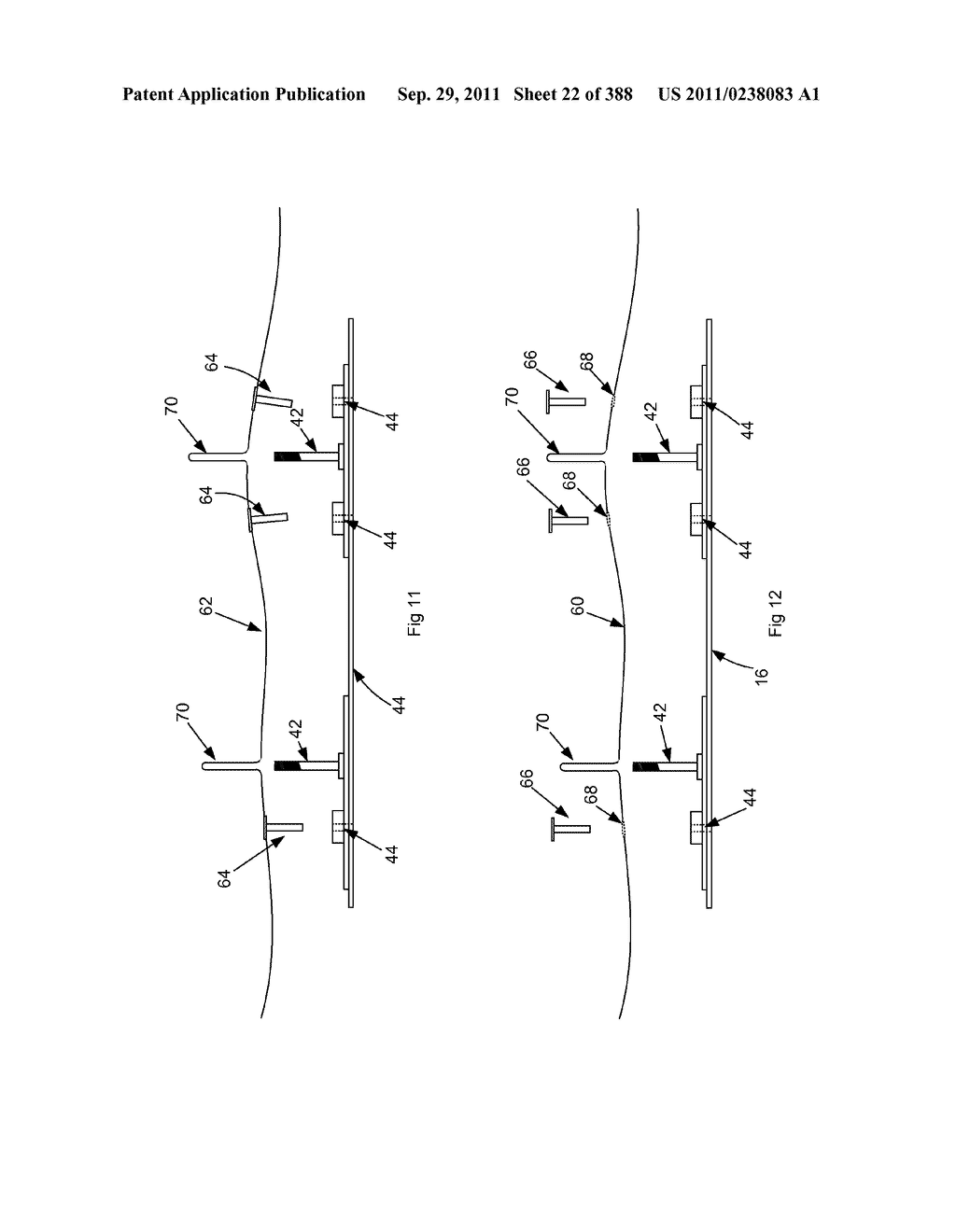 ROBOTIC CATHETER SYSTEM AND METHODS - diagram, schematic, and image 23