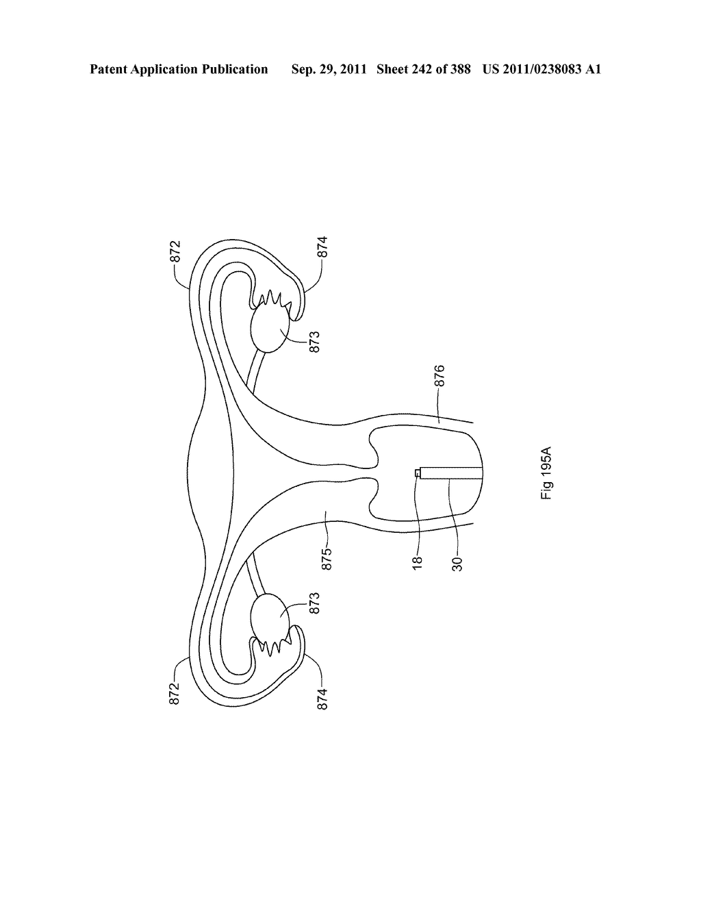 ROBOTIC CATHETER SYSTEM AND METHODS - diagram, schematic, and image 243