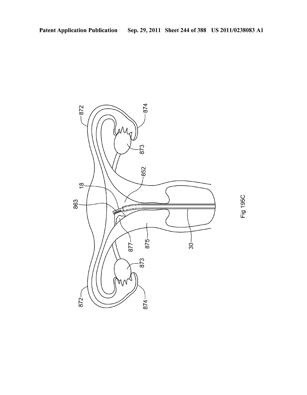 ROBOTIC CATHETER SYSTEM AND METHODS - diagram, schematic, and image 245