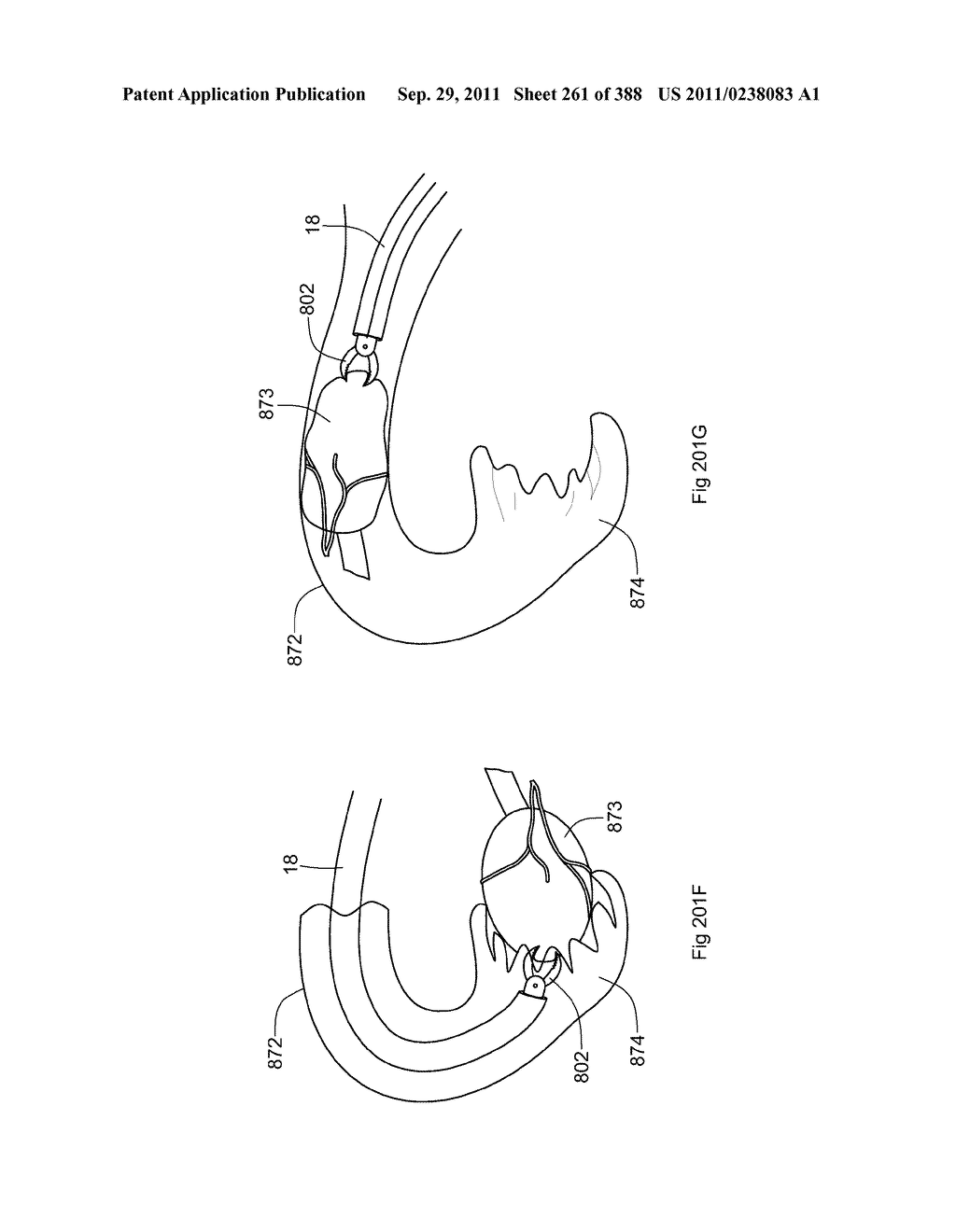 ROBOTIC CATHETER SYSTEM AND METHODS - diagram, schematic, and image 262