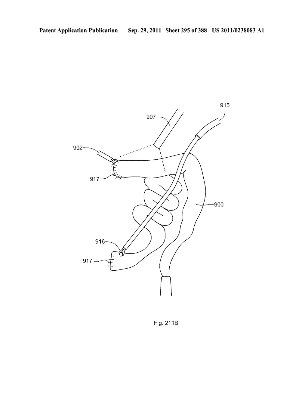 ROBOTIC CATHETER SYSTEM AND METHODS - diagram, schematic, and image 296