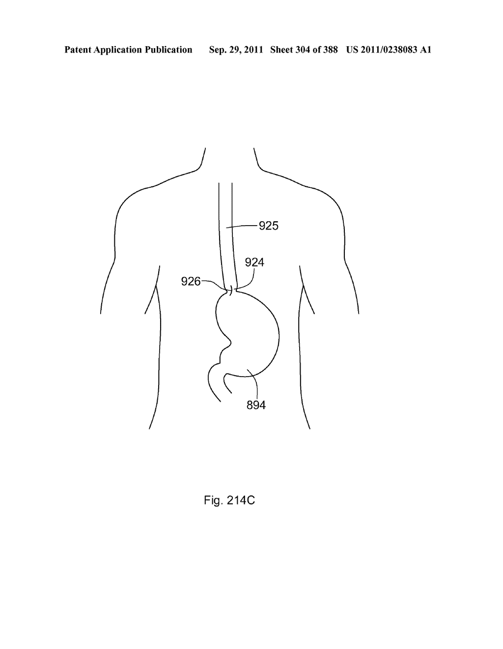 ROBOTIC CATHETER SYSTEM AND METHODS - diagram, schematic, and image 305