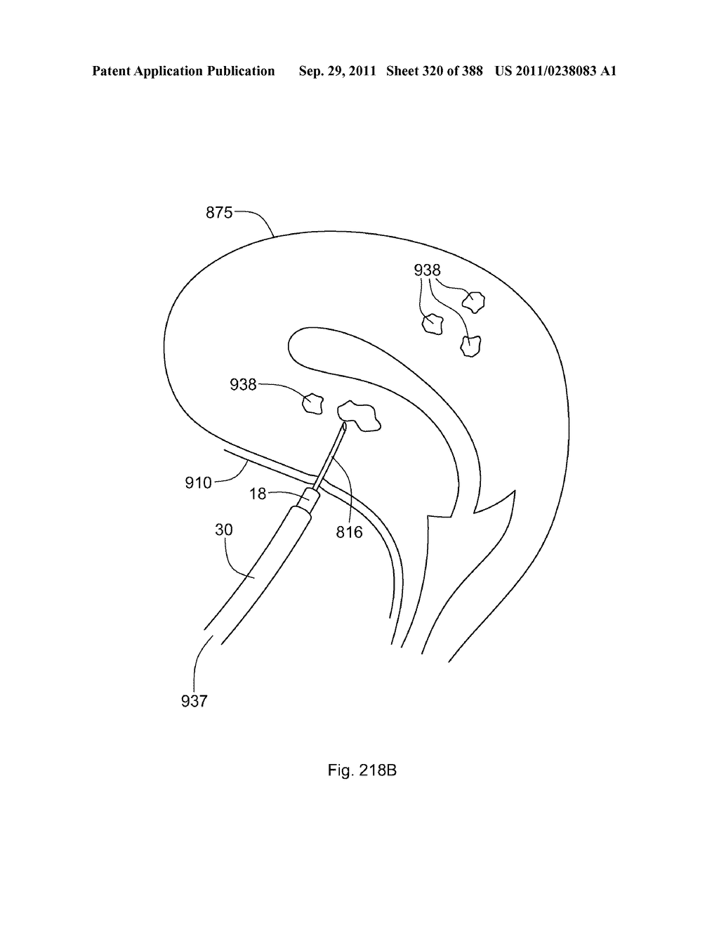 ROBOTIC CATHETER SYSTEM AND METHODS - diagram, schematic, and image 321