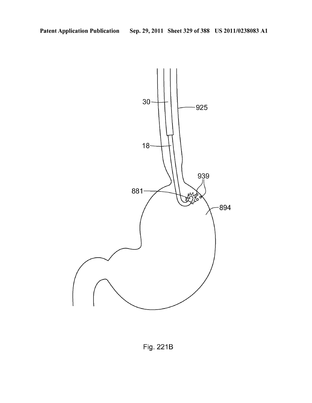 ROBOTIC CATHETER SYSTEM AND METHODS - diagram, schematic, and image 330