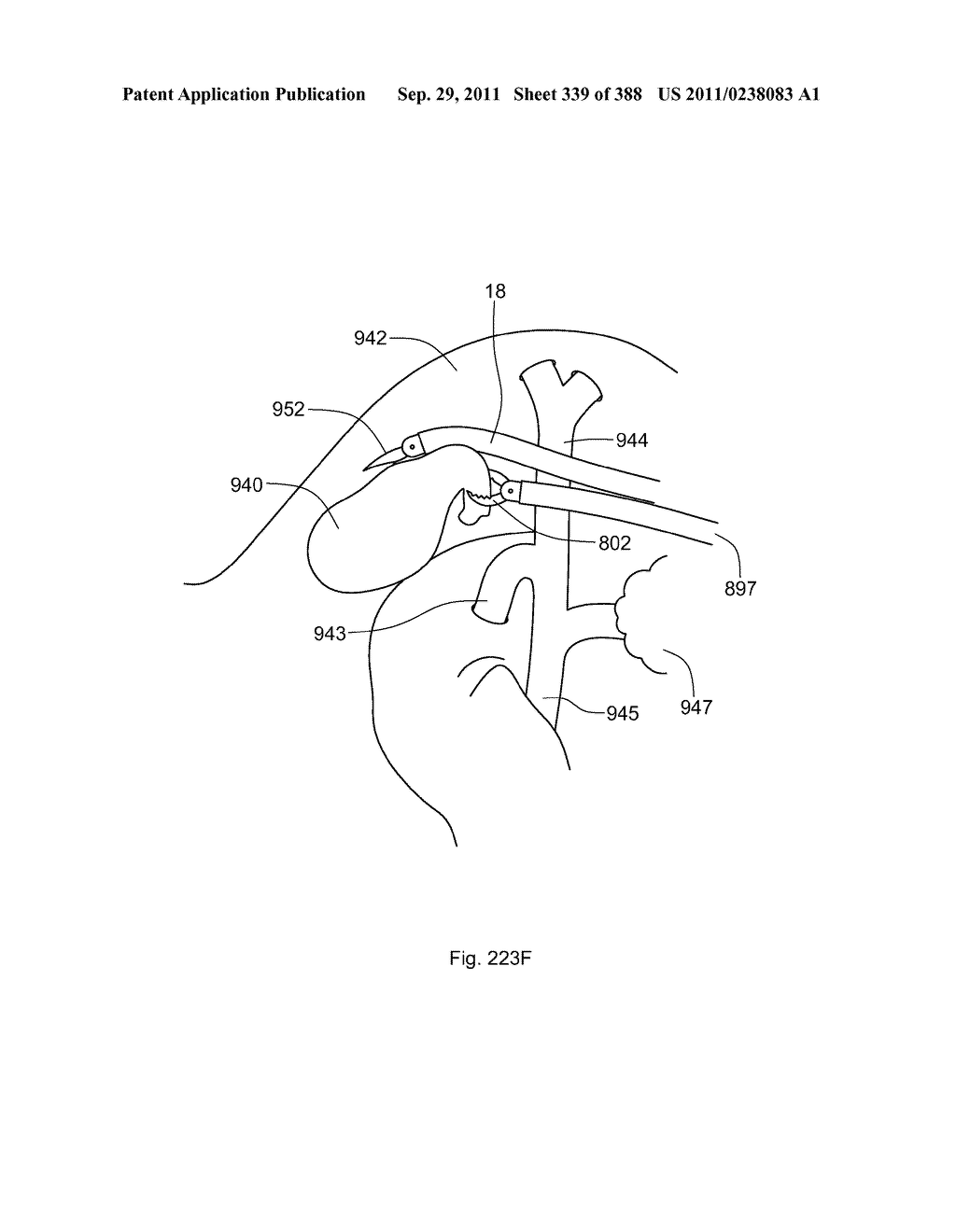 ROBOTIC CATHETER SYSTEM AND METHODS - diagram, schematic, and image 340