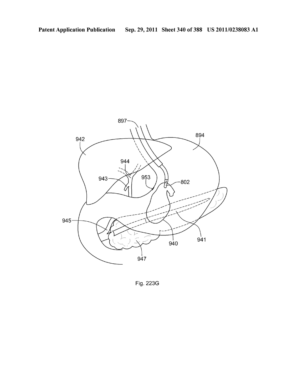 ROBOTIC CATHETER SYSTEM AND METHODS - diagram, schematic, and image 341