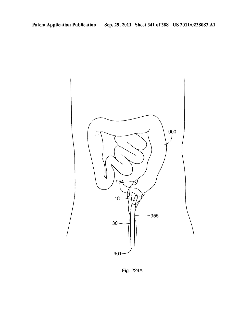 ROBOTIC CATHETER SYSTEM AND METHODS - diagram, schematic, and image 342