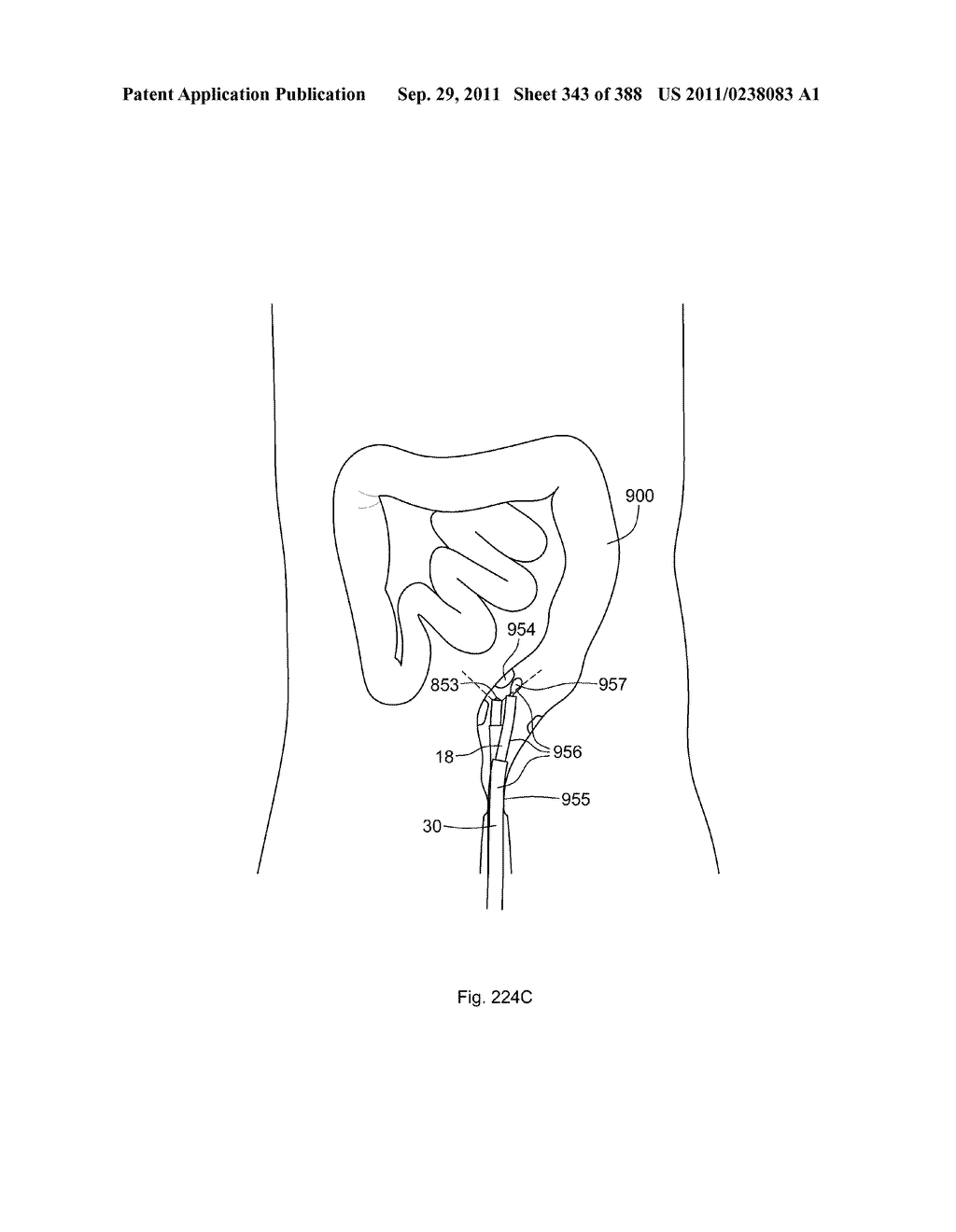 ROBOTIC CATHETER SYSTEM AND METHODS - diagram, schematic, and image 344