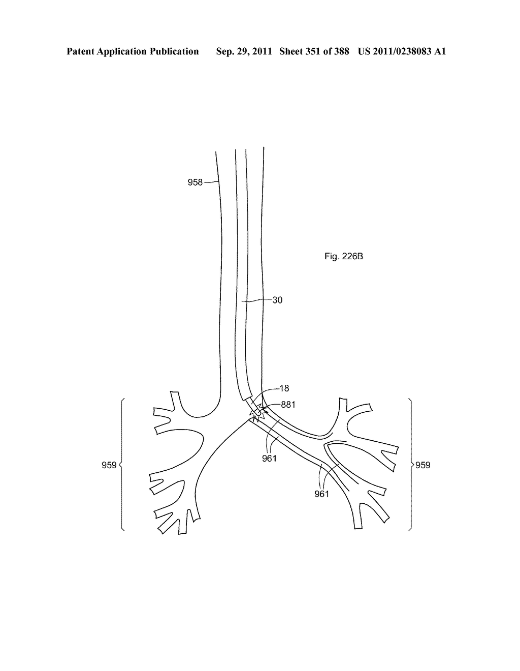 ROBOTIC CATHETER SYSTEM AND METHODS - diagram, schematic, and image 352