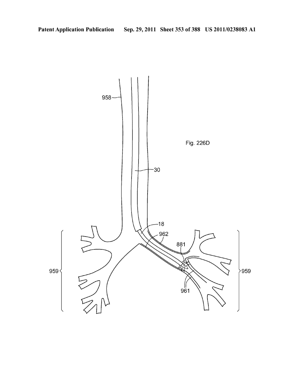 ROBOTIC CATHETER SYSTEM AND METHODS - diagram, schematic, and image 354