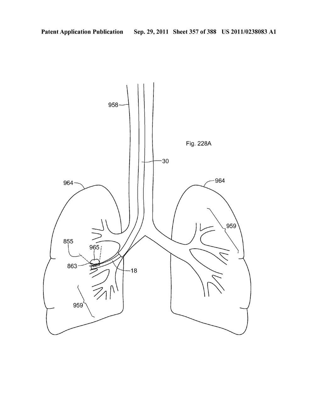 ROBOTIC CATHETER SYSTEM AND METHODS - diagram, schematic, and image 358