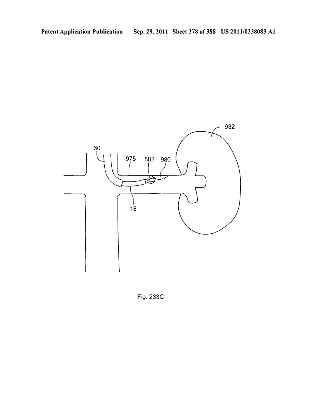 ROBOTIC CATHETER SYSTEM AND METHODS - diagram, schematic, and image 379