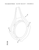 WOUND CLOSURE PRODUCT diagram and image