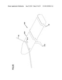 WOUND CLOSURE PRODUCT diagram and image