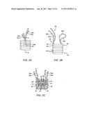 RING CINCH ASSEMBLY TO ATTACH BONE TO TISSUE diagram and image