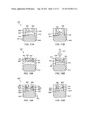 RING CINCH ASSEMBLY TO ATTACH BONE TO TISSUE diagram and image