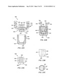 RING CINCH ASSEMBLY TO ATTACH BONE TO TISSUE diagram and image