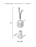 RING CINCH ASSEMBLY TO ATTACH BONE TO TISSUE diagram and image