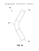 INTERSPINOUS PROCESS BRACE diagram and image