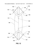 INTERSPINOUS PROCESS BRACE diagram and image