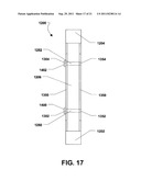 INTERSPINOUS PROCESS BRACE diagram and image