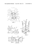 CERVICAL LINK SYSTEM diagram and image