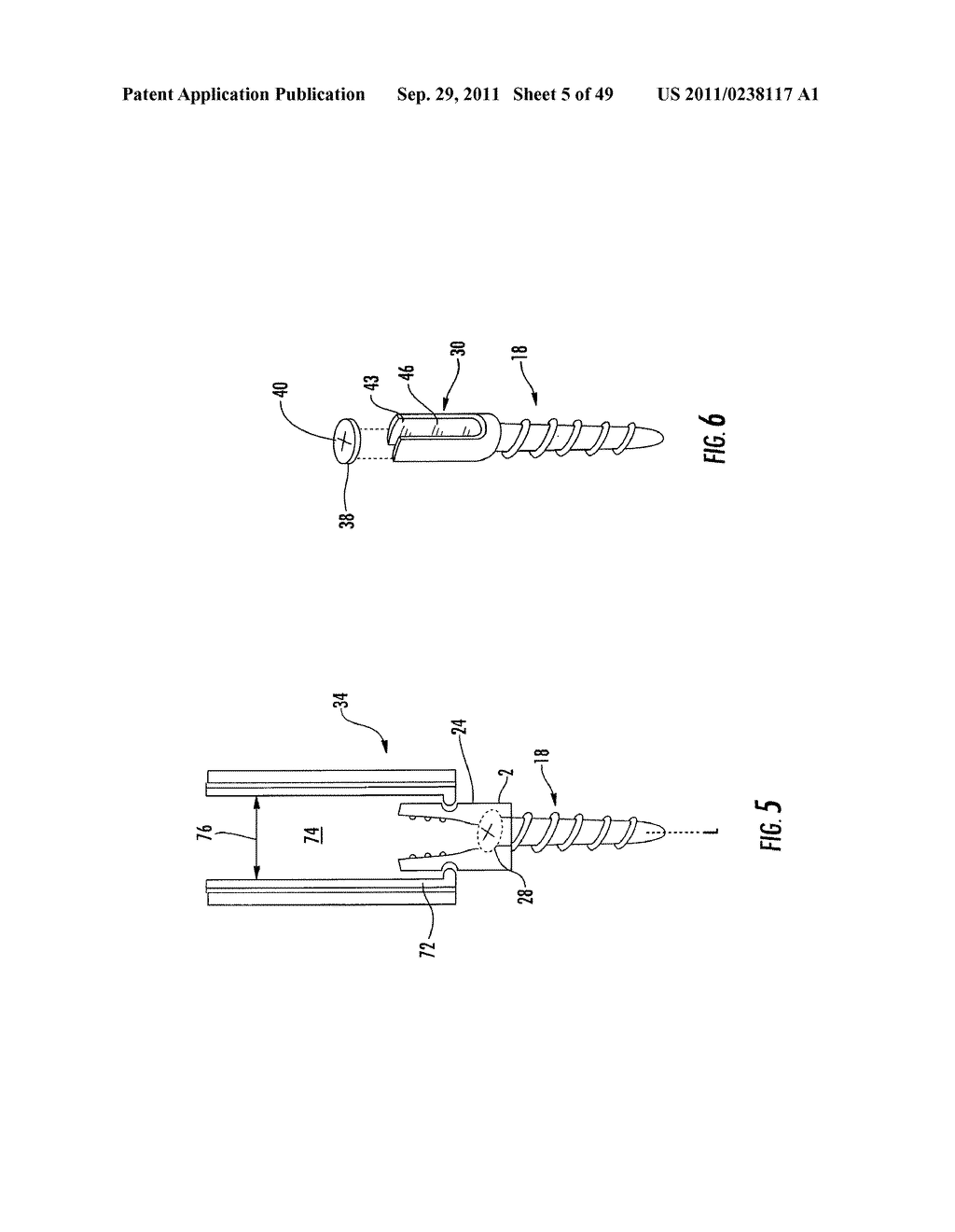 Magnetic Targeting System For Facilitating Navigation - diagram, schematic, and image 06