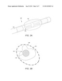 HELICAL RADIAL SPACING OF CONTACTS ON A CYLINDRICAL LEAD diagram and image