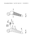 Self Powered Ostogenesis and Osseointegration Promotion and Maintenance     Device for Endosseous Implant diagram and image