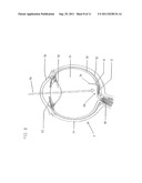 ARTIFICIAL RETINA DEVICE WITH STIMULATING AND GROUND RETURN ELECTRODES     DISPOSED ON OPPOSITE SIDES OF THE NEURORETINA AND METHOD OF ATTACHMENT diagram and image