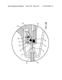 MANUAL ACTUATION SYSTEM FOR DEPLOYMENT OF IMPLANT diagram and image