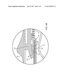 MANUAL ACTUATION SYSTEM FOR DEPLOYMENT OF IMPLANT diagram and image