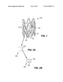 STENT FORMED FROM BIOERODIBLE METAL-BIOCERAMIC COMPOSITE diagram and image