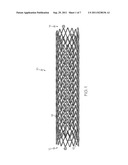 Flexible Stent Design diagram and image