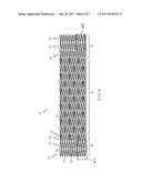 Flexible Stent Design diagram and image