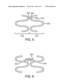 Bifurcated Stent with Variable Length Branches diagram and image