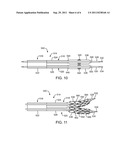 Bifurcated Stent with Variable Length Branches diagram and image