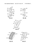 SACRO-ILIAC JOINT IMPLANT SYSTEM AND METHOD diagram and image