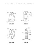 SACRO-ILIAC JOINT IMPLANT SYSTEM AND METHOD diagram and image