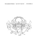 SACRO-ILIAC JOINT IMPLANT SYSTEM AND METHOD diagram and image