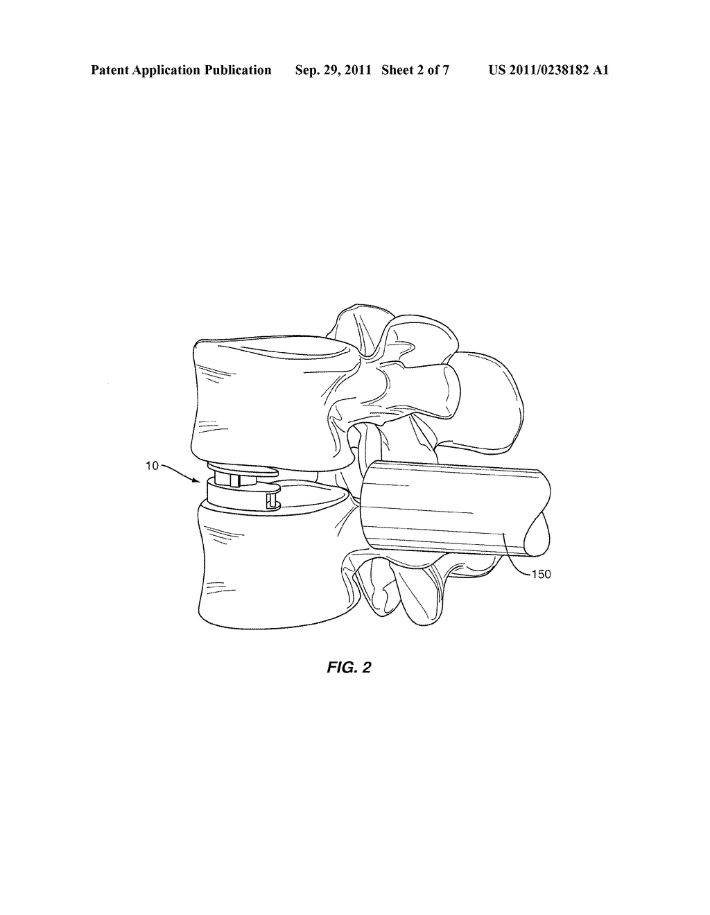 Expandable Intervertebral Spacers and Methods of Use - diagram, schematic, and image 03