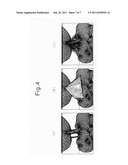 METHOD FOR GENERATING MODEL FOR PREOPERATIVE SIMULATION diagram and image