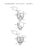 COMPOSITIONS FOR MANUFACTURING DOWNHOLE TOOLS AND DOWNHOLE TOOL PARTS diagram and image