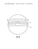 Removable Jewelry Setting diagram and image