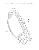 Removable Jewelry Setting diagram and image