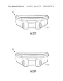 Removable Jewelry Setting diagram and image