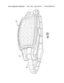 Removable Jewelry Setting diagram and image