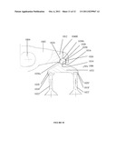 VALVE BRIDGE diagram and image