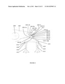 VALVE BRIDGE diagram and image